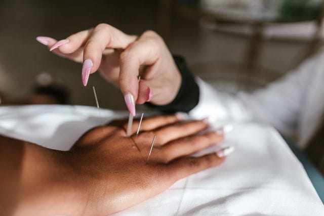 Dry Needling in Brooks: How It Works and Who Can Benefit
